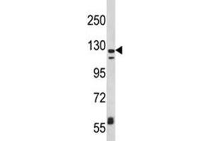 Western blot analysis of CD11c antibody and MDA-MB231 lysate.