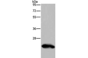 Western Blot analysis of Human placenta tissue using GH2 Polyclonal Antibody at dilution of 1:500 (Growth Hormone 2 anticorps)