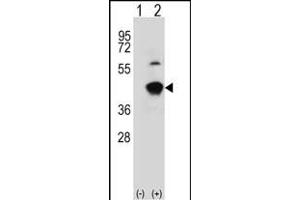 Western blot analysis of GCAT (arrow) using rabbit polyclonal GCAT Antibody (Center) (ABIN391717 and ABIN2841608). (GCAT anticorps  (AA 155-181))