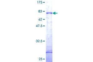 DAP Kinase 1 Protein (AA 1-368) (GST tag)