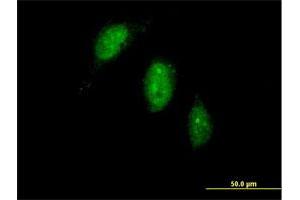 Immunofluorescence of purified MaxPab antibody to TIGD1 on HeLa cell. (TIGD1 anticorps  (AA 1-591))