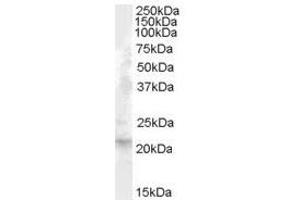 Image no. 1 for anti-Fibroblast Growth Factor 21 (FGF21) (Internal Region) antibody (ABIN374880) (FGF21 anticorps  (Internal Region))