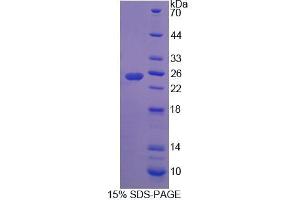 SDS-PAGE analysis of Rat RHAG Protein. (RHAG Protéine)