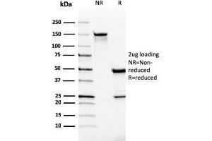 SDS-PAGE Analysis Purified Monospecific Mouse Monoclonal Antibody to VISTA (VISTA/2865).