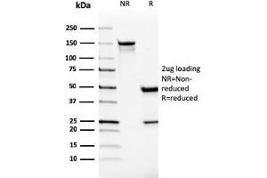 SDS-PAGE Analysis Purified Monospecific Mouse Monoclonal Antibody to VISTA (VISTA/2865). (VISTA anticorps)