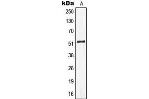Western blot analysis of Cytokeratin 13 expression in Jurkat (A) whole cell lysates.
