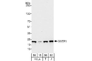 Western Blotting (WB) image for anti-Glutathione S-Transferase pi 1 (GSTP1) (AA 160-210) antibody (ABIN7453941)