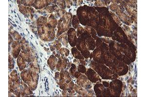 Image no. 6 for anti-Pogo Transposable Element with KRAB Domain (POGK) antibody (ABIN1500328)