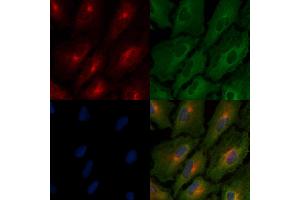 ABIN6264804 and ABIN6266494 staining  cells by IF/ICC.