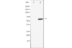 Western blot analysis of CDC25A phosphorylation expression in UV treated A549 whole cell lysates,The lane on the left is treated with the antigen-specific peptide.