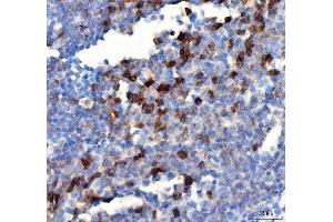 IHC analysis of PDCD1 using anti PDCD1 antibody (ABIN5518784). (PD-1 anticorps  (N-Term))