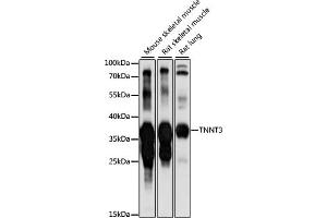 Western blot analysis of extracts of various cell lines, using TNNT3 antibody (ABIN7267145) at 1:1000 dilution.
