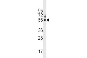 Western Blotting (WB) image for anti-Cytochrome P450, Family 3, Subfamily A, Polypeptide 5 (CYP3A5) antibody (ABIN3003497)