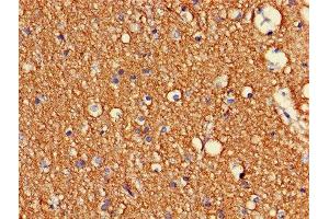 Immunohistochemistry of paraffin-embedded human brain tissue using ABIN7148931 at dilution of 1:100