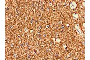Immunohistochemistry of paraffin-embedded human brain tissue using ABIN7148931 at dilution of 1:100 (CDK5 anticorps  (AA 1-292))