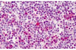 Human Tonsil: Formalin-Fixed, Paraffin-Embedded (FFPE) (BCL2L1 anticorps  (C-Term))