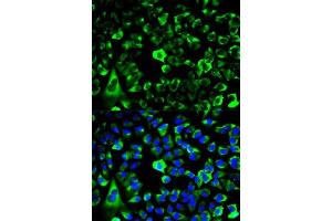 Immunofluorescence analysis of HeLa cells using RPS3 antibody. (RPS3 anticorps  (AA 1-243))