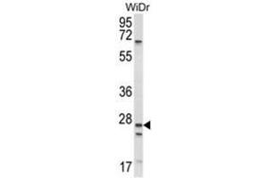 Western blot analysis of SCNN1A Antibody (Center) in WiDr cell line lysates (35ug/lane). (SCNN1A anticorps  (Middle Region))