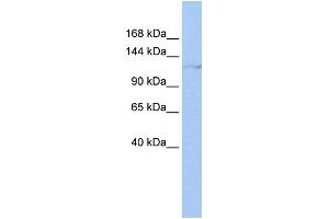 WB Suggested Anti-HLTF Antibody Titration:  0. (HLTF anticorps  (N-Term))