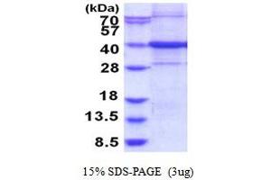 SDS-PAGE (SDS) image for Chromosome 9 Open Reading Frame 100 (C9orf100) (AA 1-335) protein (His tag) (ABIN5853920)