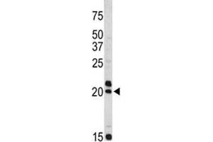 Western blot analysis of VIP antibody and Jurkat lysate.