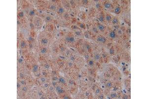 IHC-P analysis of Human Tissue, with DAB staining. (MGLL anticorps  (AA 1-303))