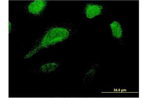 Immunofluorescence of monoclonal antibody to GLE1 on HeLa cell.