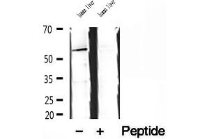 Western blot analysis of extracts of human liver tissue, using SKAP2 antibody.