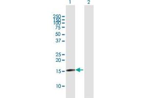 Western Blot analysis of TSEN15 expression in transfected 293T cell line by TSEN15 MaxPab polyclonal antibody.