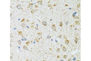 Immunohistochemistry of paraffin-embedded Rat brain using COG2 Polyclonal Antibody at dilution of 1:100 (40x lens). (COG2 anticorps)