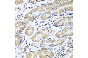 Immunohistochemistry of paraffin-embedded human stomach using EIF1AX antibody at dilution of 1:100 (40x lens). (EIF1AX anticorps)