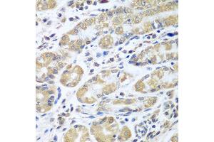 Immunohistochemistry of paraffin-embedded human stomach using EIF1AX antibody at dilution of 1:100 (40x lens).