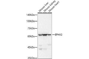 Western blot analysis of extracts of various cell lines, using EPHX2 antibody (ABIN7266999) at 1:500 dilution. (EPHX2 anticorps)