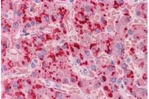 Human Liver: Formalin-Fixed, Paraffin-Embedded (FFPE) (APOA2 anticorps  (AA 1-100))
