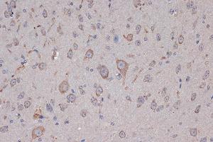 Immunohistochemistry of paraffin-embedded mouse brain using Xanthine Oxidase (XDH) (XDH) Rabbit mAb (ABIN7271408) at dilution of 1:100 (40x lens). (XDH anticorps)