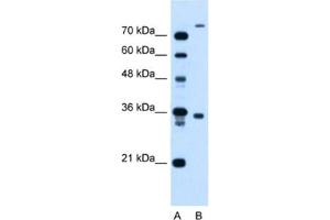 Western Blotting (WB) image for anti-FLJ22167 antibody (ABIN2464002) (FLJ22167 anticorps)