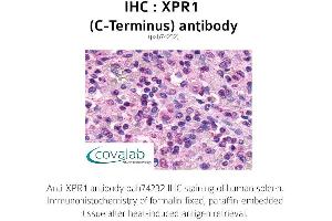 Image no. 1 for anti-Xenotropic and Polytropic Retrovirus Receptor 1 (xpr1) (C-Term) antibody (ABIN1740877) (xpr1 anticorps  (C-Term))