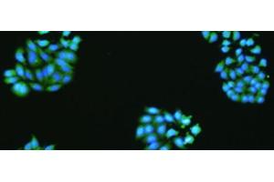 The image is immunofluorescence of HepG2 cell using VMA21 Polyclonal Antibody at dilution of 1:50. (VMA21 anticorps)