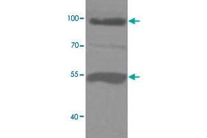 Western blot analysis of human fetal liver lysate with ADAMTS8 polyclonal antibody  at 1 : 1000 dilution. (ADAMTS8 anticorps  (C-Term))