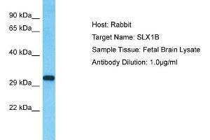 Host: Rabbit Target Name: SLX1B Sample Type: Fetal Brain lysates Antibody Dilution: 1. (SLX1A/GIYD2 anticorps  (N-Term))