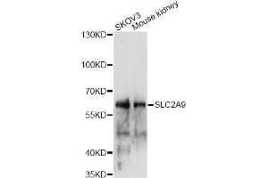 Western blot analysis of extracts of various cell lines, using SLC2A9 antibody (ABIN6291465) at 1:1000 dilution.