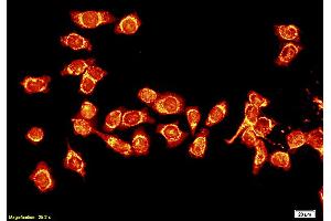 Formalin-fixed and paraffin embedded human tongue squamous carcinoma cells labeled with Anti-Lamin A, Unconjugated (ABIN735188) followed by conjugation to the secondary antibody