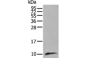 Western blot analysis of Human lung tissue lysate using CCL18 Polyclonal Antibody at dilution of 1:400 (CCL18 anticorps)