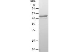 Western Blotting (WB) image for WW and C2 Domain Containing 2 (WWC2) (AA 1-242) protein (His-IF2DI Tag) (ABIN7125744) (WWC2 Protein (AA 1-242) (His-IF2DI Tag))