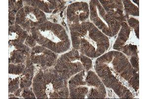 Image no. 9 for anti-OTU Domain, Ubiquitin Aldehyde Binding 1 (OTUB1) antibody (ABIN1499933)