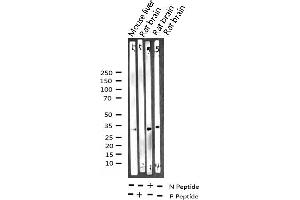 Western blot analysis of Phospho-NPM (Thr199) expression in various lysates (NPM1 anticorps  (pThr199))