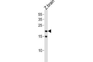 Western Blotting (WB) image for anti-Transcription Factor 21 (TCF21) antibody (ABIN3004721)