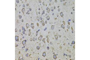 Immunohistochemistry of paraffin-embedded mouse brain using CRHR1 antibody (ABIN5974846) at dilution of 1/100 (40x lens). (CRHR1 anticorps)