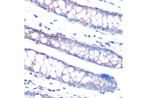 Immunohistochemistry of paraffin-embedded human colon using DUSP6 Rabbit mAb (ABIN7266848) at dilution of 1:100 (40x lens). (DUSP6 anticorps)