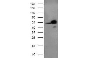 Western Blotting (WB) image for anti-Retinoblastoma Binding Protein 7 (RBBP7) antibody (ABIN1500626)
